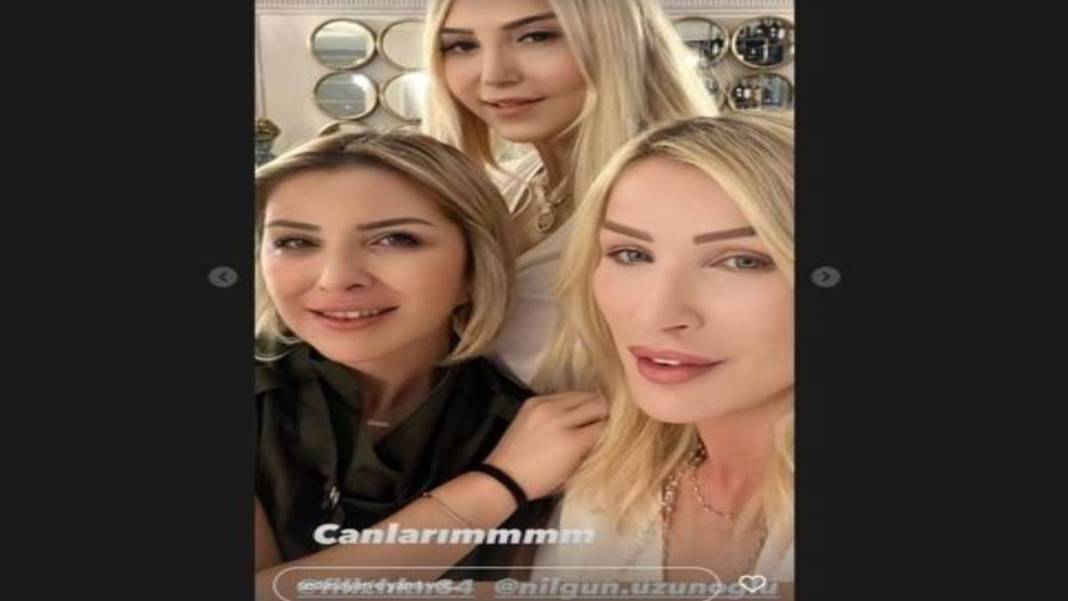 Estetik de çözüm olmadı! Seda Sayan çareyi bakın nede buldu: Abla burnun yok olmuş 3